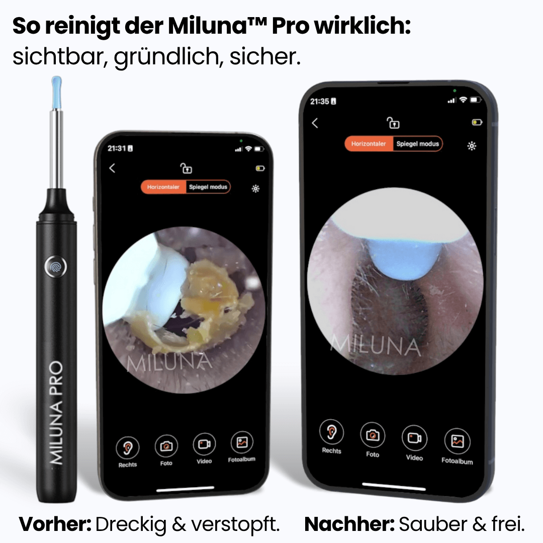 Miluna™ Pro