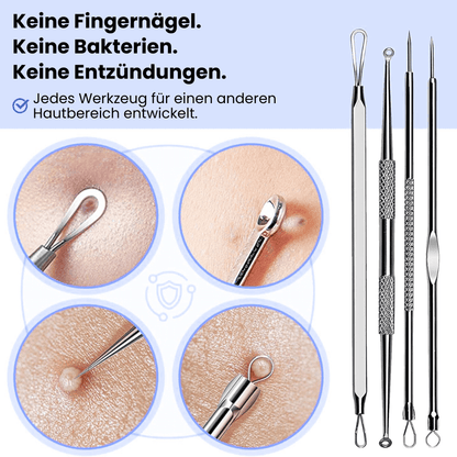 Mitesserentferner & Komedonen-Set