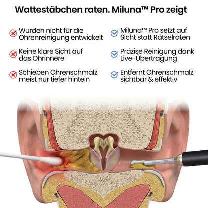 Miluna® Pro