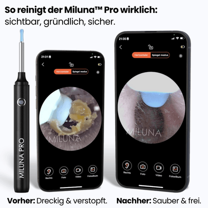 Miluna™ Pro