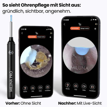 Miluna™ Pro